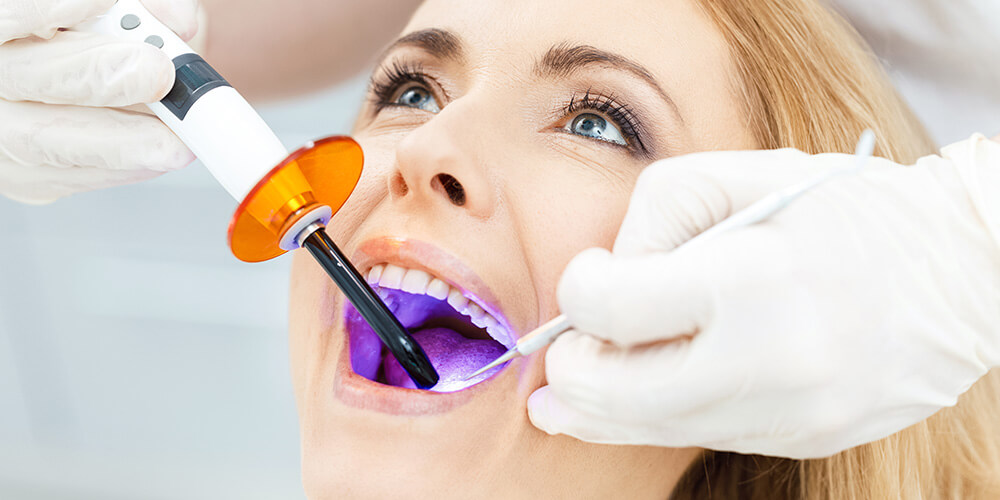 Dental Bonding Carleton Place