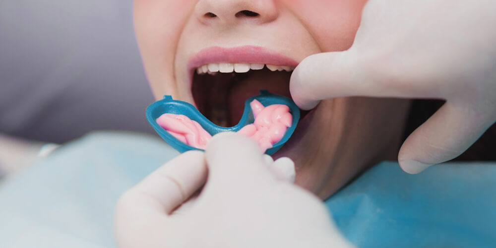 Fluoride Treatment Carleton Place