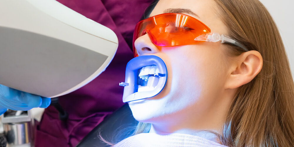 Teeth Whitening Carleton Place